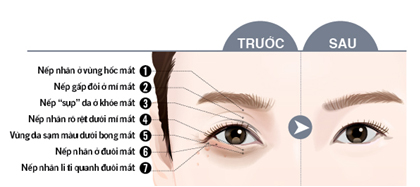 Tinh chất serum dưỡng ẩm điều trị lão hóa vùng mắt